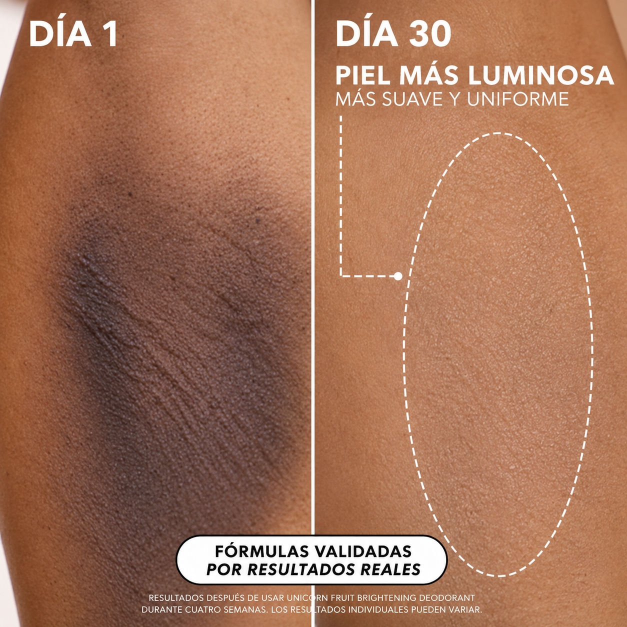 Aviora™ Desodorante Iluminador y Suavizante