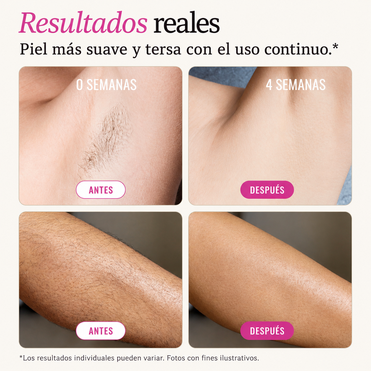 Aviora™ Aceite Rotundus para Cuerpo y Cabello