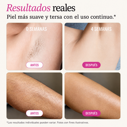 Aviora™ Aceite Rotundus para Cuerpo y Cabello