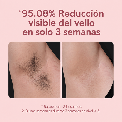 Aviora™ Depiladora IPL